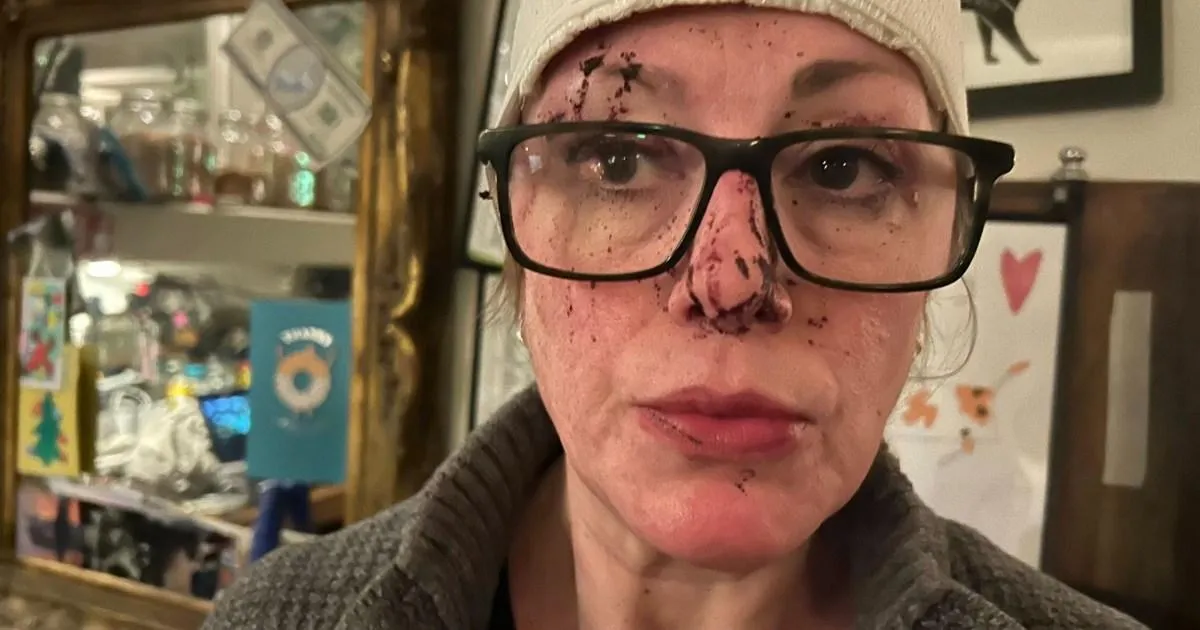 'I was nearly beaten to death after I refused a man a pint - then I almost had my pub taken away' | News UK