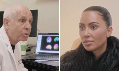 Kim Kardashian's New Scan Shows Low Brain Activity, Studying Stress To Blame