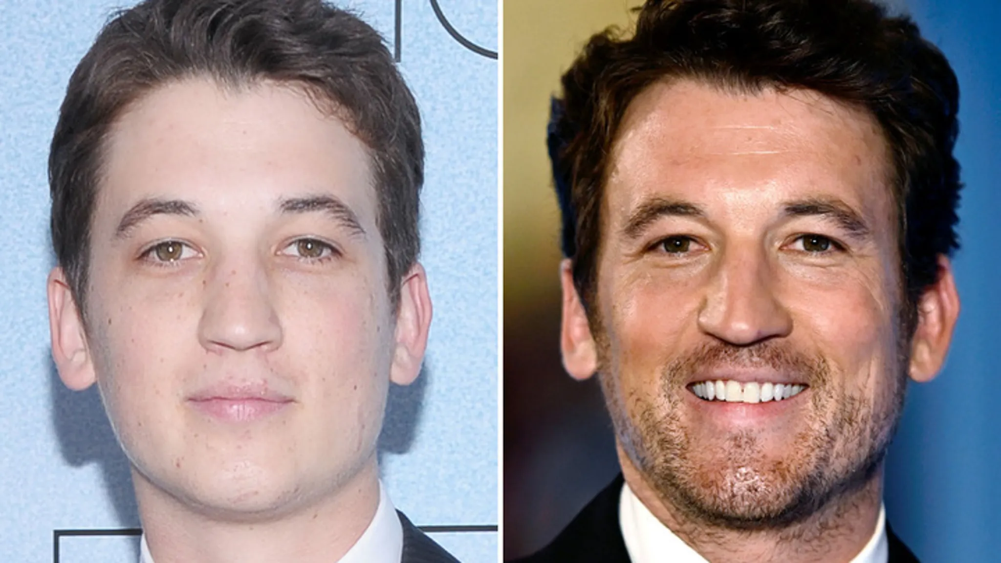 Miles Teller -- Good Genes or Good Docs?!