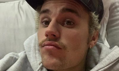 Justin Bieber Suffers Painful Rib Injury After Onewheel Skateboard Accident
