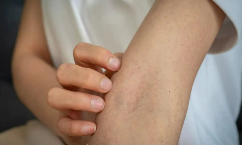 From two types of cancer to STIs