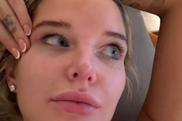 Helen Flanagan in car crash as she admits suffering 'rubbish' end to 2025