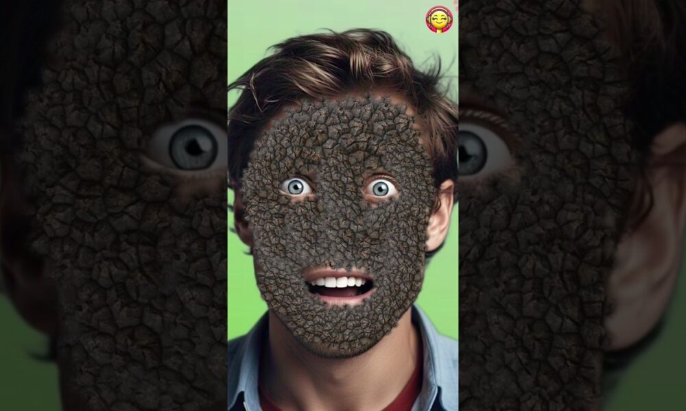 Sunik Bhai ke Chaere Pe hua pather 😷😭 #shorts #entertainment