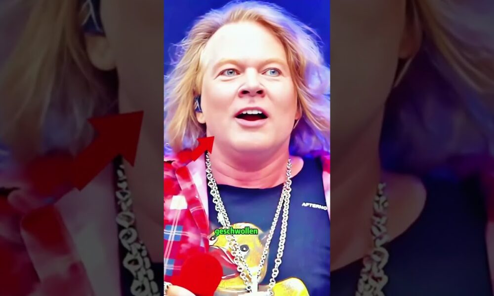 Dieser Sänger hatte eine misslungene Schönheitsoperation. #Entertainment #lustig #ShowbizNews