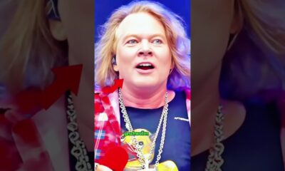 Dieser Sänger hatte eine misslungene Schönheitsoperation. #Entertainment #lustig #ShowbizNews