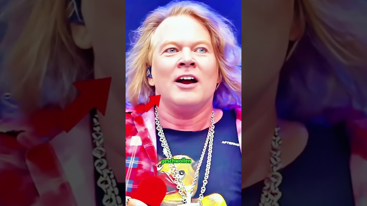 Dieser Sänger hatte eine misslungene Schönheitsoperation. #Entertainment #lustig #ShowbizNews