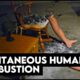 Only The Legs Remain | Spontaneous Human Combustion