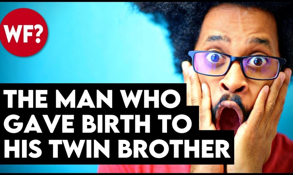 The Man Who Gave Birth -- To His TWIN