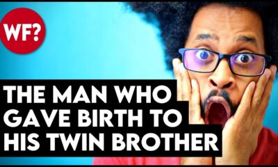 The Man Who Gave Birth -- To His TWIN