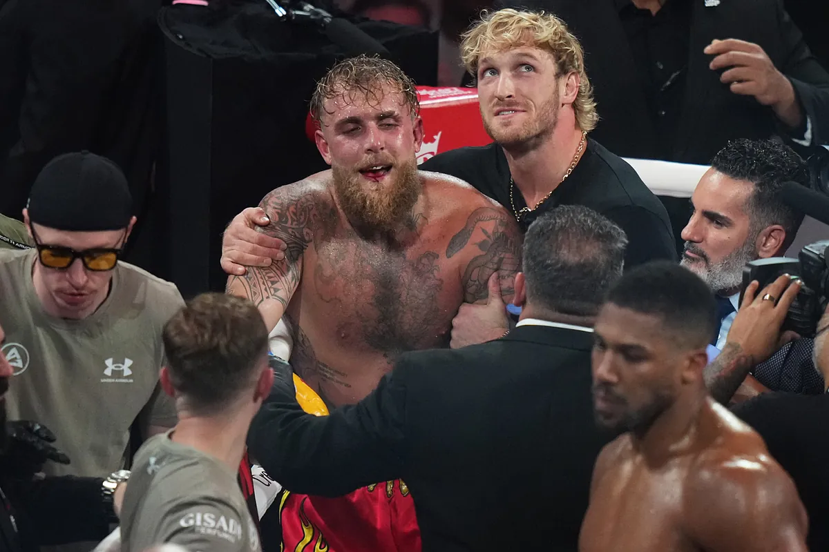 Jake Paul gives humble post-Anthony Joshua interview with bloodied, broken jaw