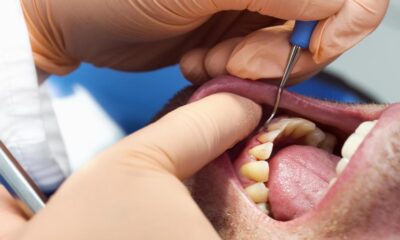 Dentist warns of common habit that could cause gum disease