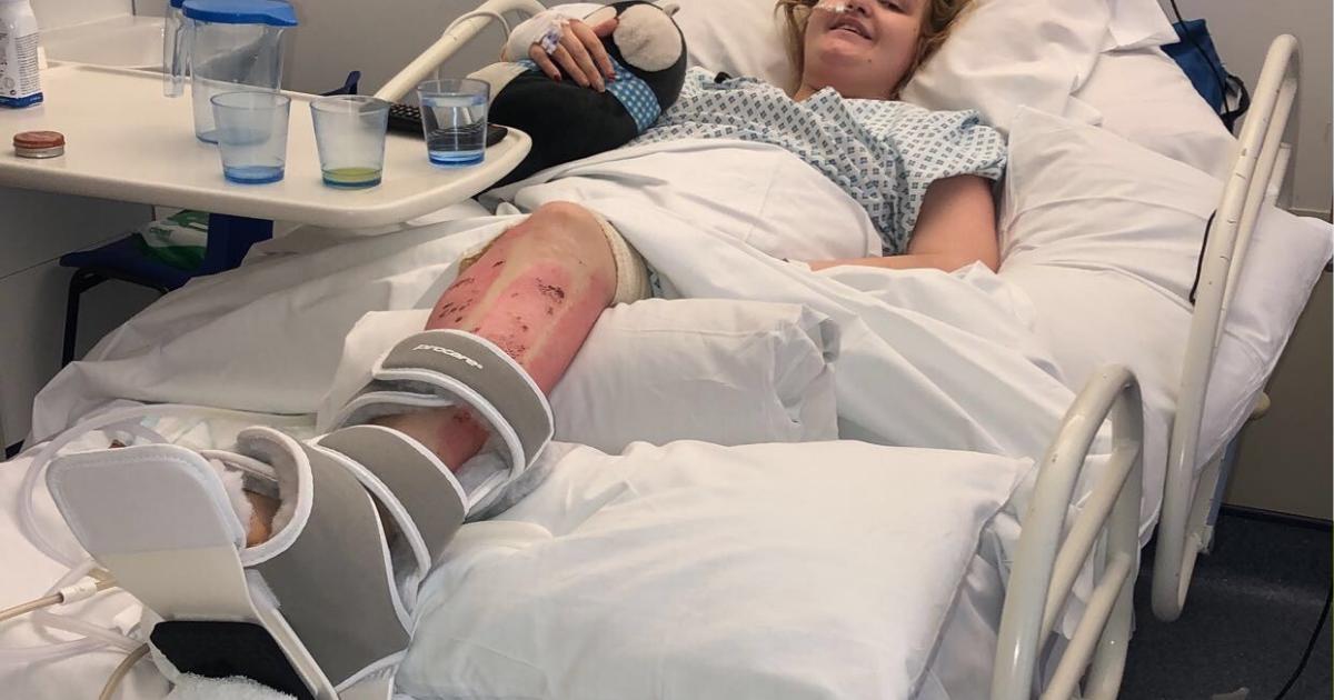 Woman who lost leg in 'devastating' tractor crash helps NHS blood appeal