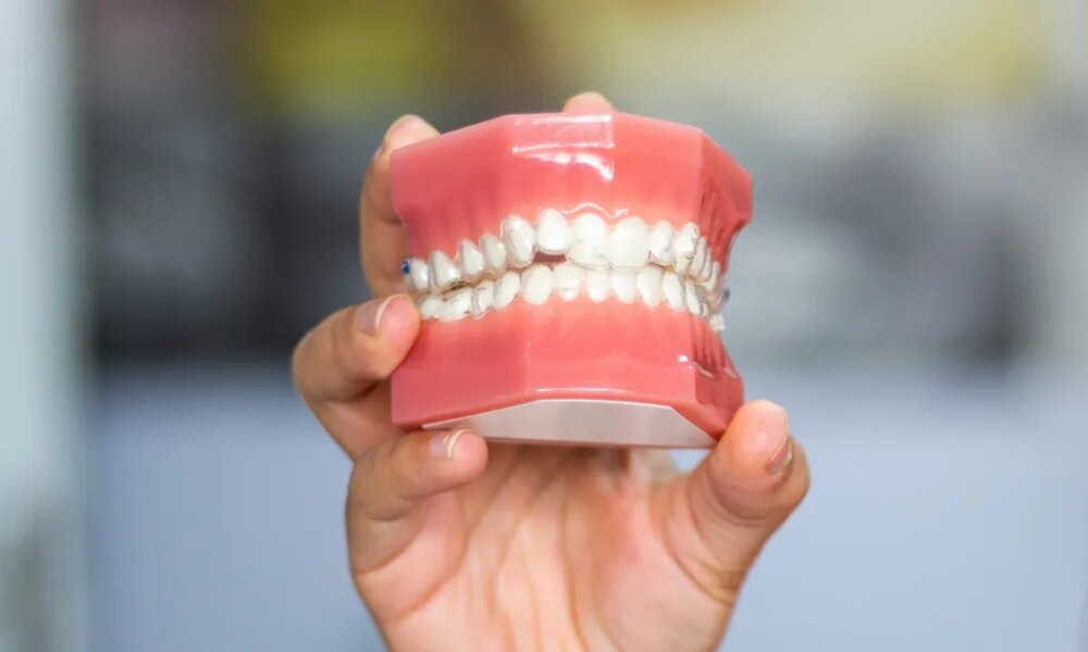 6 Dental Signs A Dentist Says Reveal Hormonal Issues