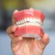 6 Dental Signs A Dentist Says Reveal Hormonal Issues