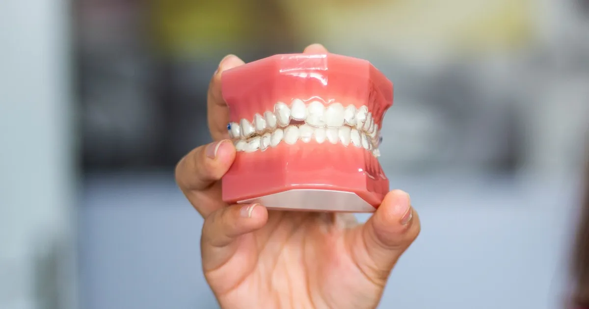 6 Dental Signs A Dentist Says Reveal Hormonal Issues