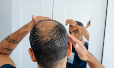 r/Bald On Reddit Is The Nicest Place Online