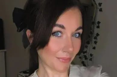 'Agonising' skin condition left mum-of-two looking like she had 'permanent sunburn' with bumps over her face