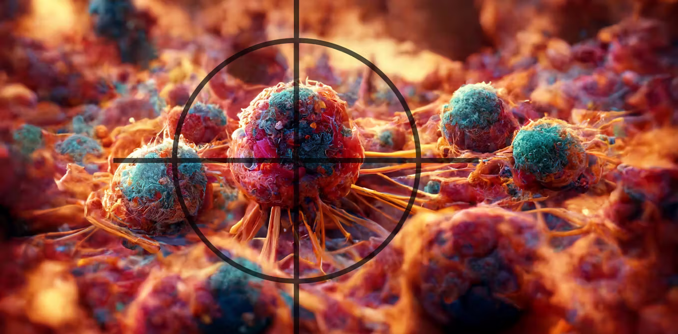 how sound waves could change the future of tumour treatment