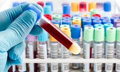 Your blood proteins could predict your risk of an early death