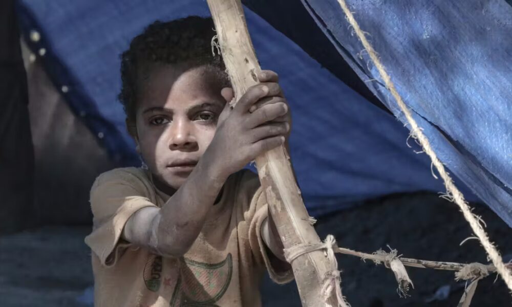 How displacement reshapes refugees’ gut health