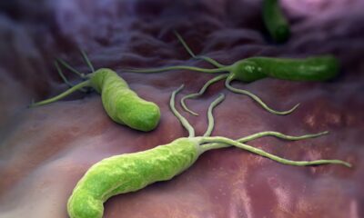 This part of the body may hold the key to protecting the brain against Alzheimer’s