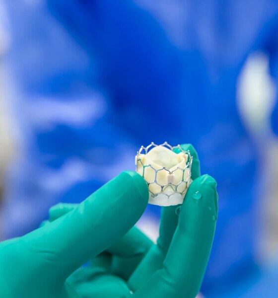 The Edwards Lifesciences Dilemma Persists: Strong Growth Potential, High Price (NYSE:EW)