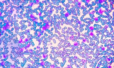 Bristol Myers Squibb Stock: A Pharma Giant Trading Like Growth Is Over - It's Not (BMY)