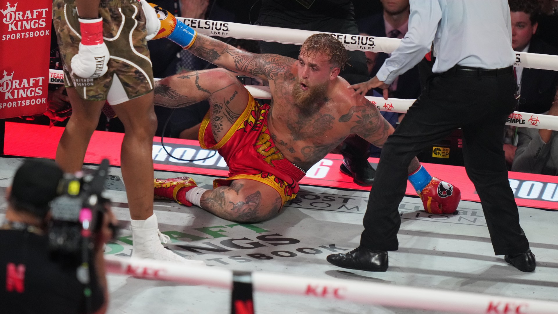 Jake Paul shares injury update after undergoing surgery following broken jaw and reveals he can't eat for a WEEK