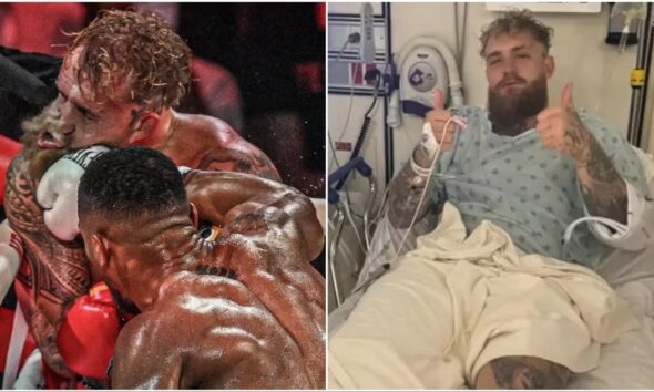 Jake Paul Tweets Post-Anthony Joshua Loss Health Update After Surgery