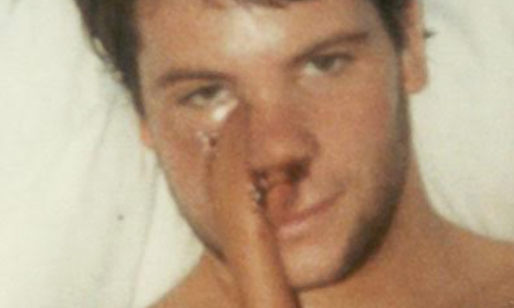 How I Learned To Embrace My Face After Cancer Surgery