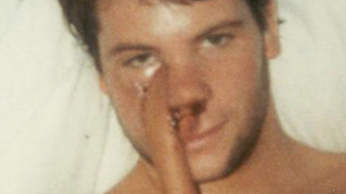 How I Learned To Embrace My Face After Cancer Surgery