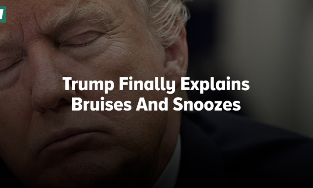 Trump Finally Explains Bruises And Snoozes