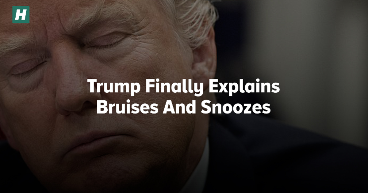 Trump Finally Explains Bruises And Snoozes