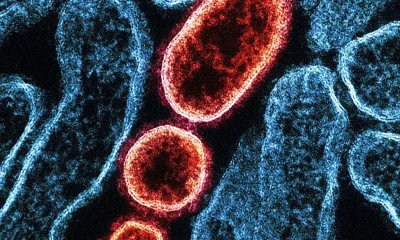 Nipah Virus: Symptoms, Locations, And UK Risk Explained