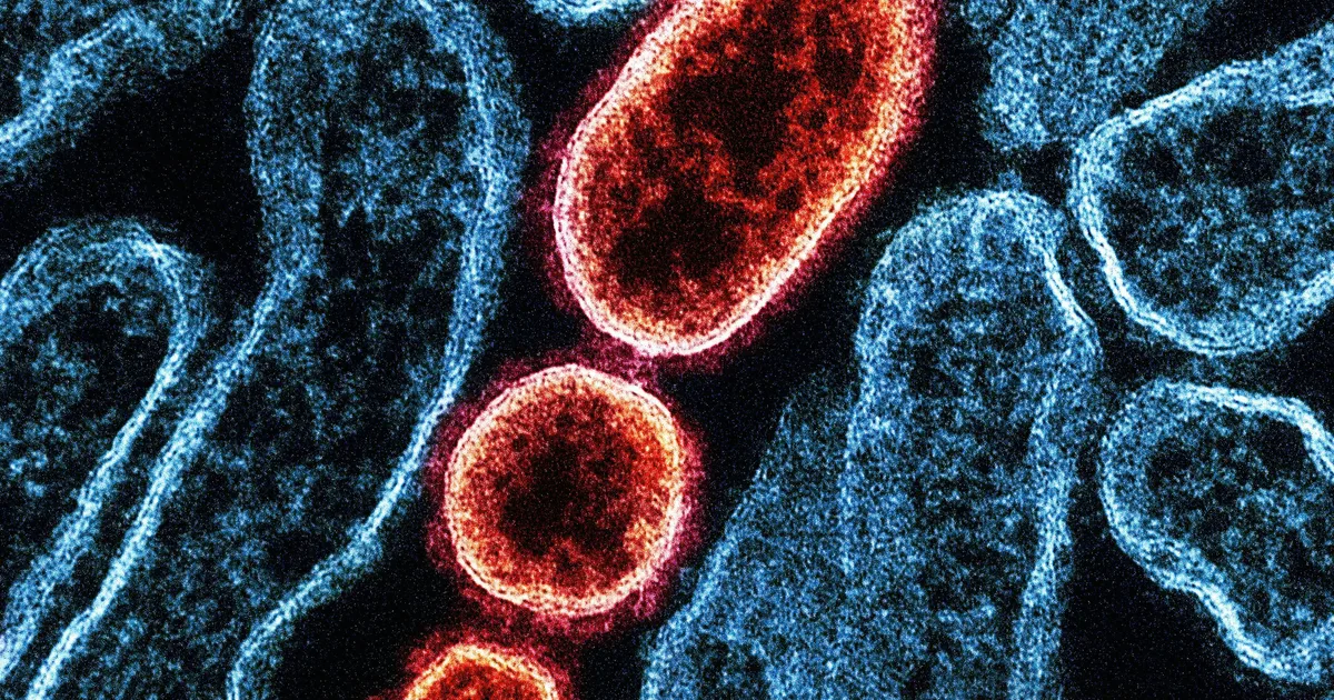 Nipah Virus: Symptoms, Locations, And UK Risk Explained