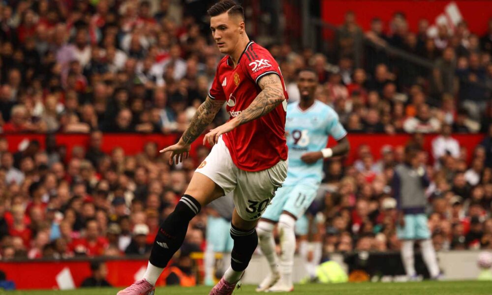 How to watch and follow match preview: Burnley (A)