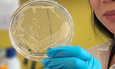 Study helps explain rare condition that causes the body to produce its own alcohol