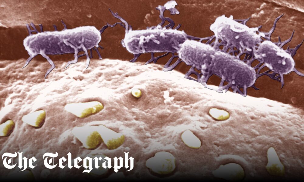 Superbug fears as new drug-resistant strains of typhoid emerge in Asia