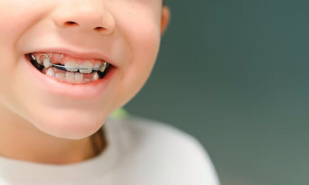 why our ancestors didn’t need straight teeth