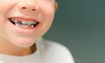 why our ancestors didn’t need straight teeth