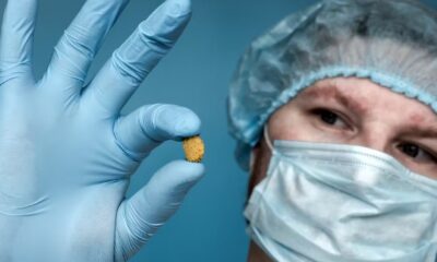 where and why your body makes stones