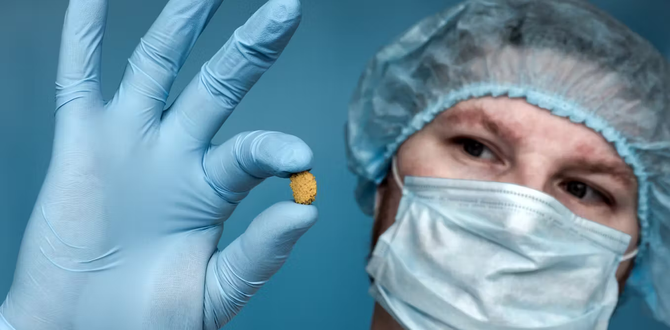 where and why your body makes stones