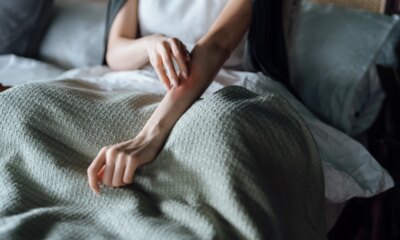 Alumis Up On Phase 3 Envudeucitinib Success: Oral Psoriasis Therapy Shows Promise