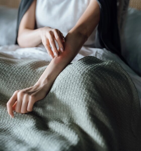 Alumis Up On Phase 3 Envudeucitinib Success: Oral Psoriasis Therapy Shows Promise