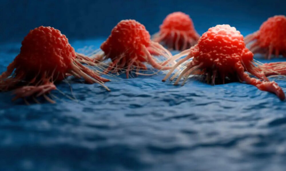 Alpha Tau: Pancreatic, GBM, And Other Updates; Set Up For A Strong, Catalyst-Rich 2026