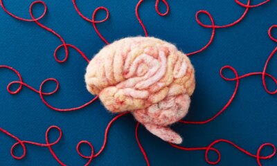 Axsome Therapeutics: A Conditional Buy Built On SG&A Discipline