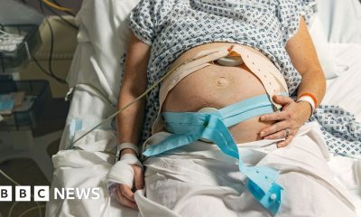 Racism and staffing issues factors in 'failing' maternity care, report finds