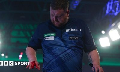 Cameron Menzies pictured with blood on his right hand as he leaves the stage following his loss at the World Championship