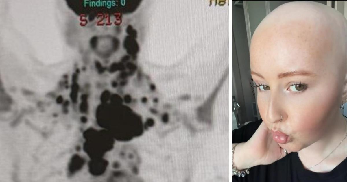 Chester-le-Street 22-year-old diagnosed with stage 4 cancer