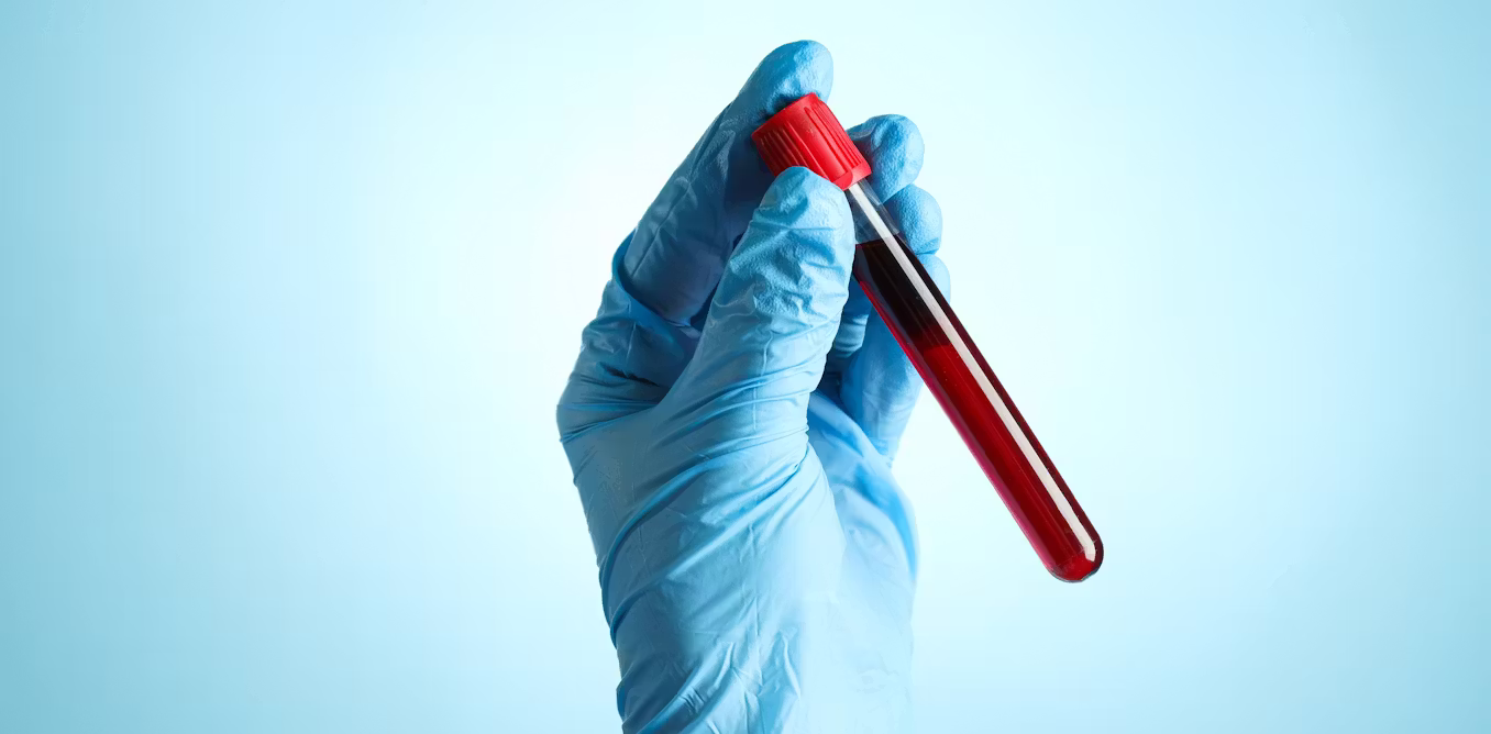 the iron overload condition that too often goes undiagnosed